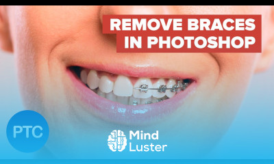 The BEST Way to Remove Braces With Photoshop