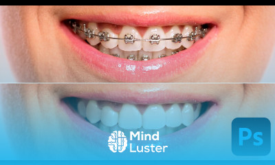 Remove Braces in Photoshop Easy Pro Level Results