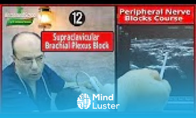 Supraclavicular Plexus Block Ultrasound Guided peripheral Nerve Blocks Course Mohamed Hamada 12