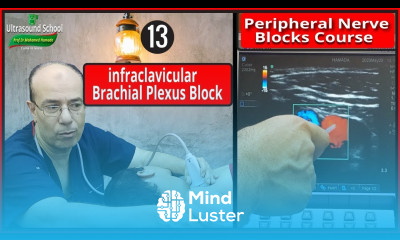Infraclavicular Plexus Block Ultrasound Guided peripheral Nerve Blocks Course Mohamed Hamada 13