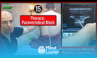 Thoracic Paravertebral Block Ultrasound Guided peripheral Nerve Blocks Course Mohamed Hamada 15