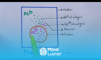 Erythroblastosis fetalis Hemolytic anemia Rh incompatibility Symptoms Bio science