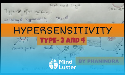 Hypersensitivity Type 3 and Type 4