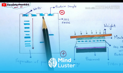 Western blotting technique Detection of proteins Principle Procedure Bio science