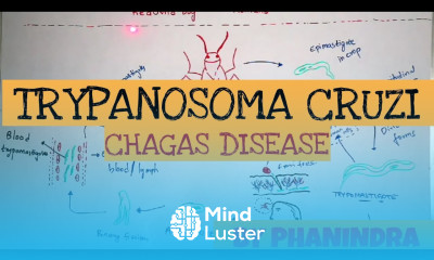 CHAGAS DISEASE TRYPANOSOMA CRUZI STRUCTURE LIFE CYCLE SYMPTOMS BY PHANINDRA GUPTHA