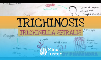 TRICHINOSIS TRICHINELLA SPIRALIS STRUCTURE LIFE CYCLE SYMPTOMS BY PHANINDRA GUPTA
