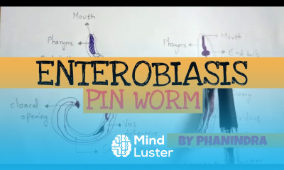 ENTEROBIASIS PINWORM STRUCTURE LIFE CYCLE SYMPTOMS BY PHANINDRA GUPTA