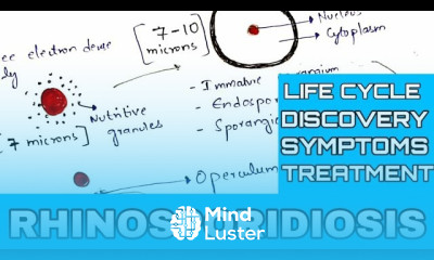 Rhinosporidiosis Rhinosporidium seeberi Life cycle symptoms Treatment