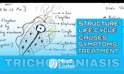 Trichomoniasis Trichomonas vaginalis Sexually transmitted disease