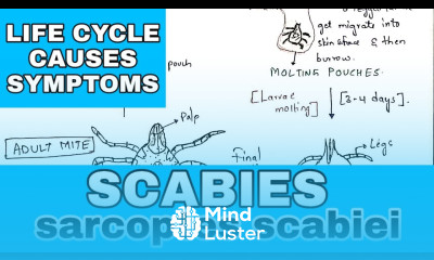 Scabies sarcoptes scabiei Life cycle causes symptoms Bio science