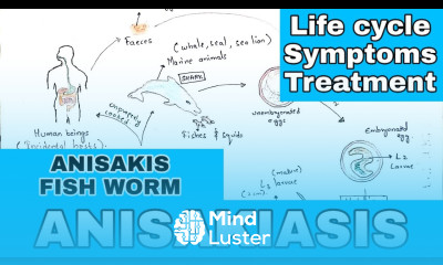 Anisakiasis Anisakis Life cycle symptoms treatment By phanindra gupta