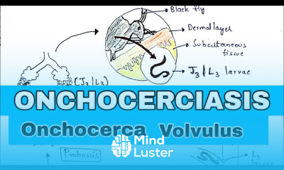 onchocerciasis River blindness Life cycle symptoms and treatment Bio science