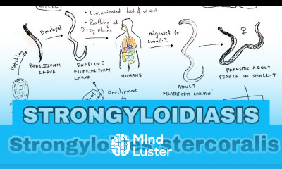 Strongyloidiasis Life cycle Symptoms Treatment Strongyloides stercoralis Bio science