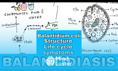Balantidiasis Balantidium coli Structure Life cycle Symptoms Medication Bio science
