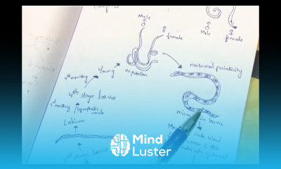 Elephantiasis Wuchereria bancrofti By Phanindra gupta