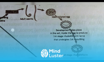 NOTES FOR ASCARIS LUMBRICOIDS INTER 1ST YEAR BY PHANINDRA GUPTA