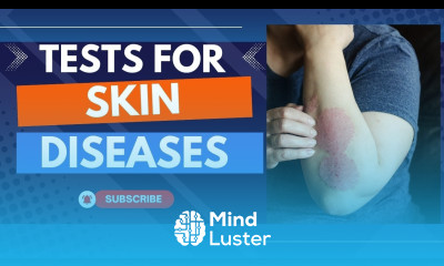 Blood test for skin diseases Blood tests for skin problems