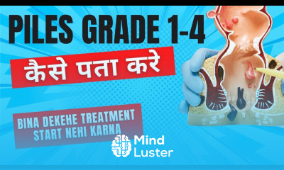Piles grade 1 4 Bawasir ke lakshan kaise hota hai Piles grade 1 to 4 in Hindi