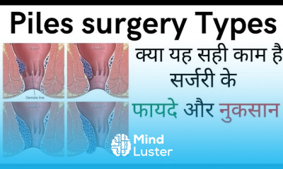 Piles surgery in Hindi piles injection surgery cost and laser surgery
