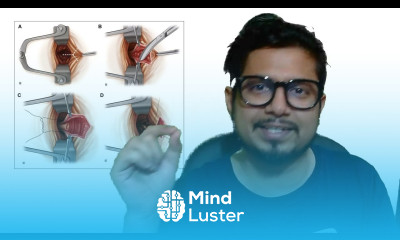 Laser surgery for piles cost recovery time Laser treatment for piles