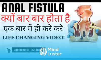Fistula recurrence Fistula surgery fail Cure fistula in one surgery