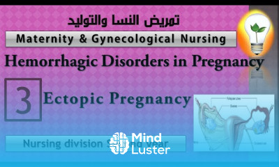 Maternity Nursing 3 Ectopic Pregnancy الحمل خارج الرحم