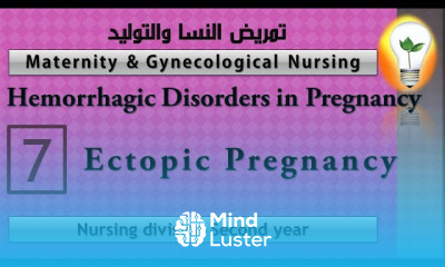 Maternity Nursing 7 Ectopic Pregnancy الحمل خارج الرحم 2