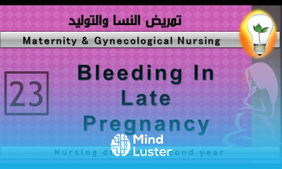 Maternity Nursing 23 Bleeding in late pregnancyالنزيف في نهايات الحمل