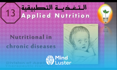 Applied Nutrition 13 Nutritional management of chronic diseases تغذية الأطفال ذوي الأمراض المزمنة