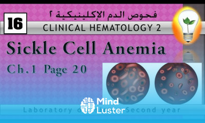 Clinical Hematology 16 Sickle Cell Disease part 2 الأنيميا الخلايا المنجلية