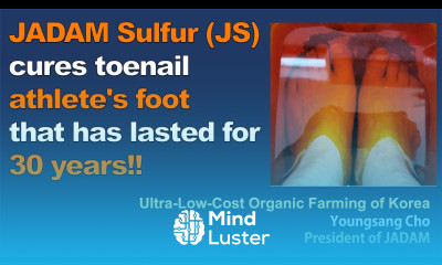 JADAM Sulfur JS cures toenail athlete s foot that has lasted for 30 years