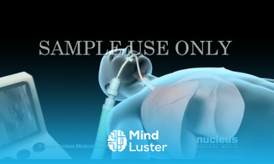 Intubación y ventilación mecánica