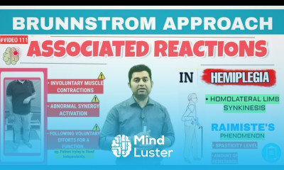 IMPORTANT ASSOCIATED REACTIONS SEEN IN STROKE HEMIPLEGIA PATIENTS