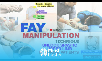 FAY MANIPULATION TECHNIQUE TO UNLOCK UPPER LIMB SPASTIC JOINTS IN STROKE HEMIPLEGIA PATIENTS