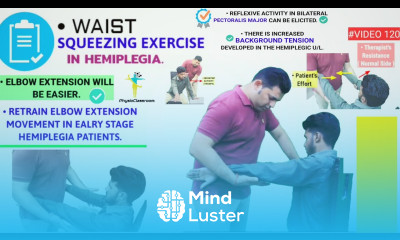 WAIST SQUEEZING EXERCISE TECHNIQUE DEVELOPING ELBOW EXTENSION CONTROL IN ACUTE STROKE PATIENTS